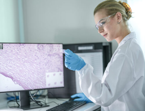 Why colorectal cancer is rising in young adults — a scientific overview